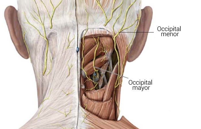 Neuralgia de Arnold